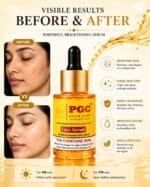 PGC Prism Glow Cosmetics Face Serum before and after skin transformation comparison banner showing visible results for hyperpigmentation and dull skin reduction