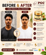 Before and after skincare transformation infographic for Prism Glow Avocado Night Cream, showing a man's journey from an uneven, dull skin tone to a clear, fresh, and glowing complexion in 5 days.