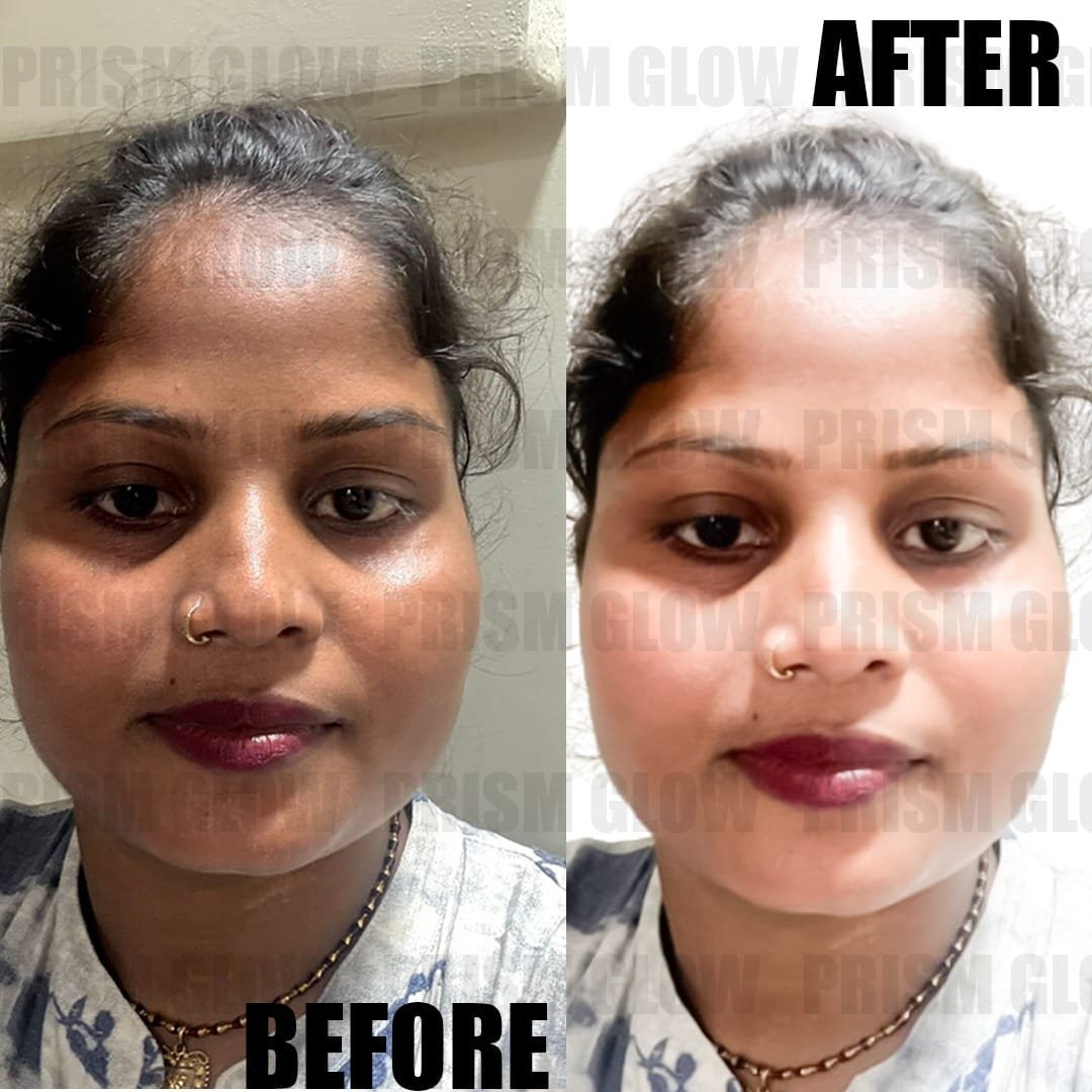 After Before -Prism Glow Cosmetics -01
