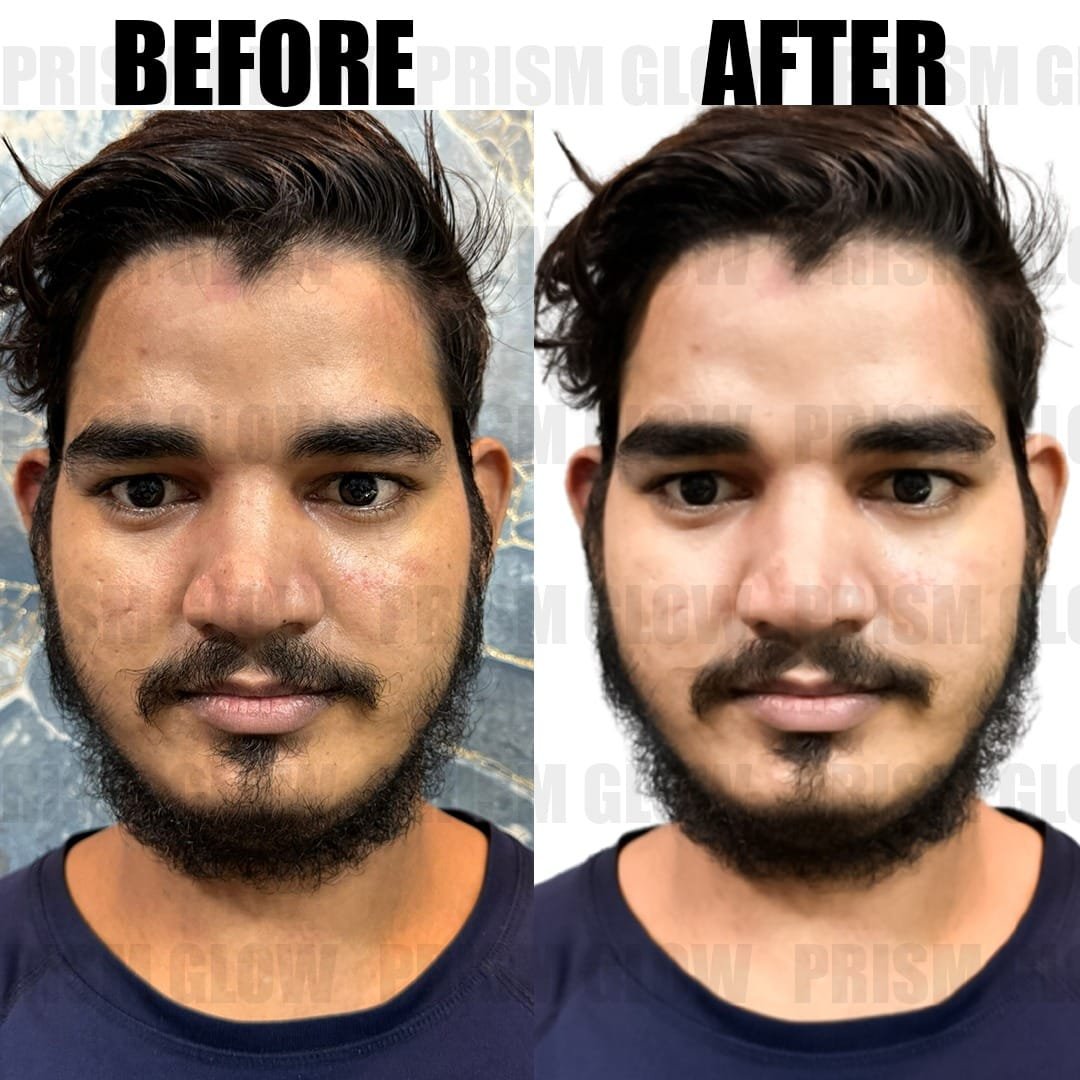 After Before -Prism Glow Cosmetics -04