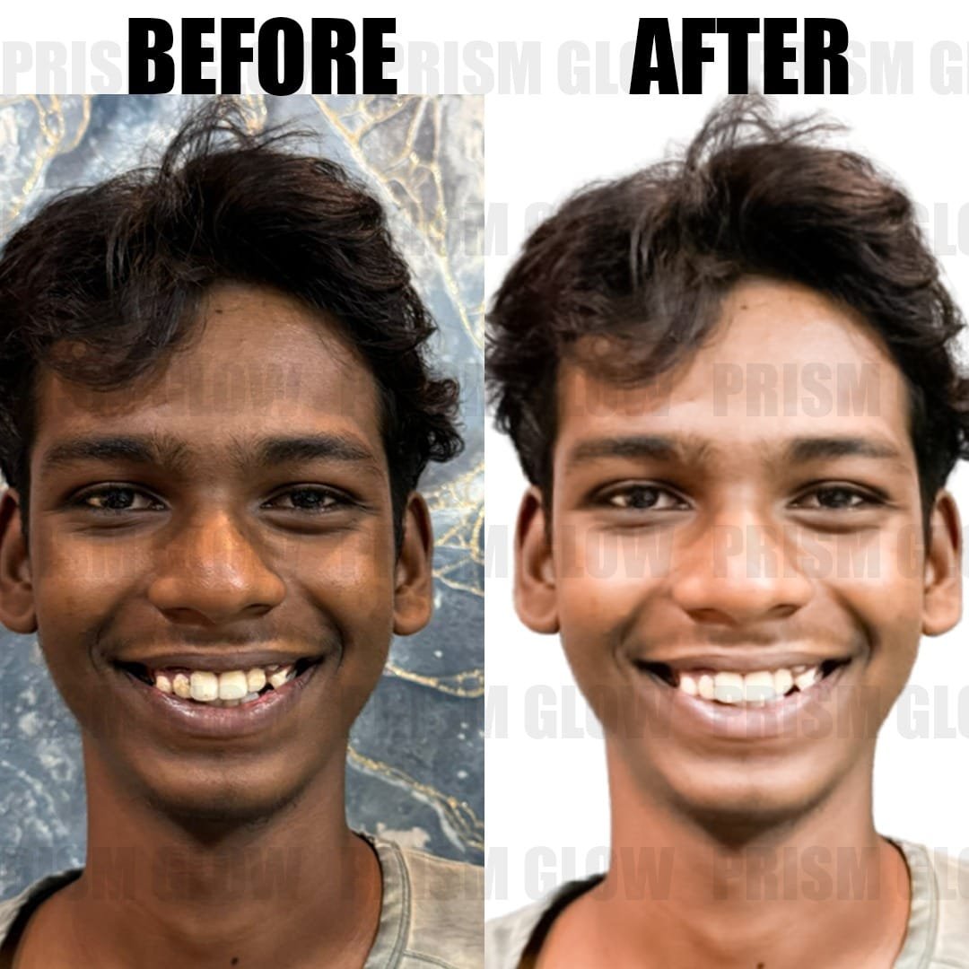 After before - priwm glow cosmetics